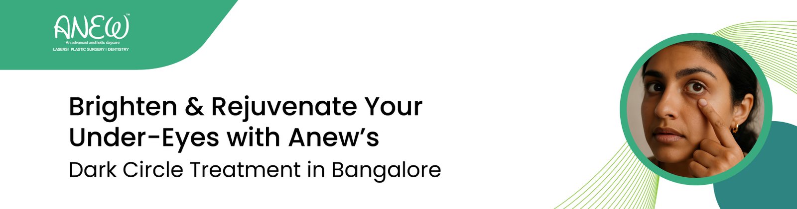 dark circle treatment in bangalore